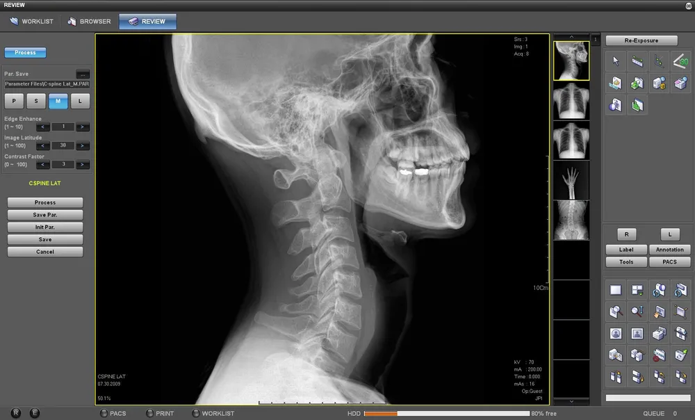 Digital X-ray technology at Family First Chiropractic